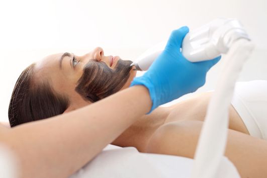 Woman receiving an activated carbon mask