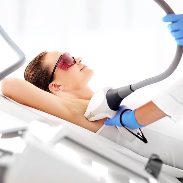 A person undergoing laser hair removal 